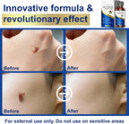TWICETWO Fast-Acting Skin Tag Remover (30ml)