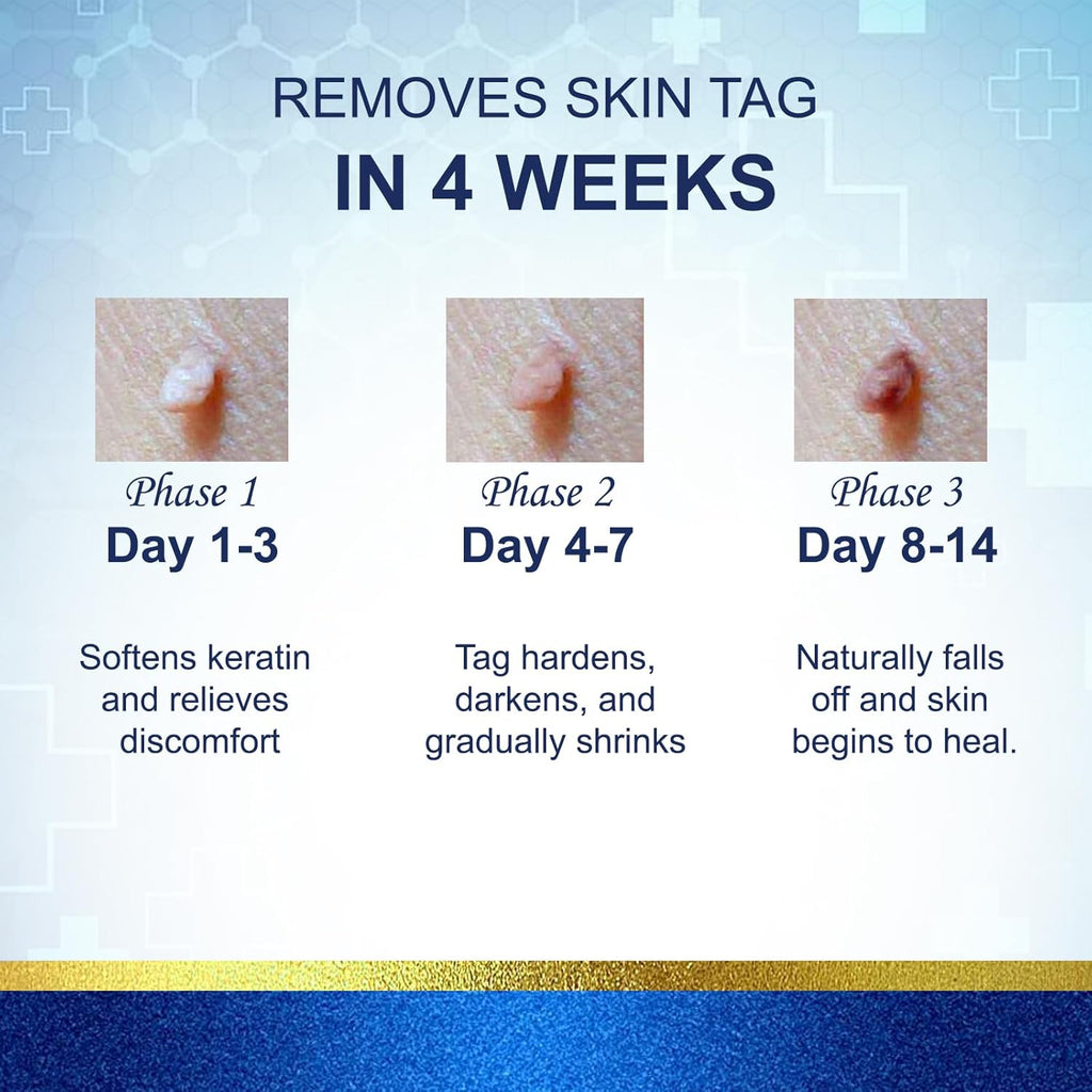 TWICETWO Fast-Acting Skin Tag Remover (30ml)
