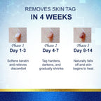 TWICETWO Fast-Acting Skin Tag Remover (30ml)
