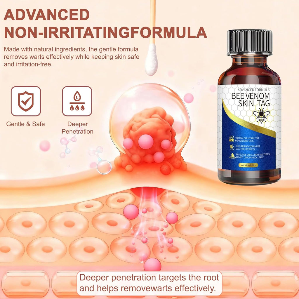 TWICETWO Fast-Acting Skin Tag Remover (30ml)