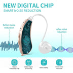 Coniler BTE Hearing Aids for Seniors – Battery Powered, Noise Reduction, Comfortable Behind - the - Ear Amplifiers (Pair) - Sixin1